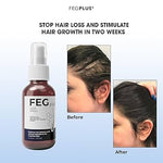 Load image into Gallery viewer, FEG Plus  Hair Growth spry
