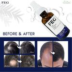 Load image into Gallery viewer, FEG Plus  Hair Growth spry
