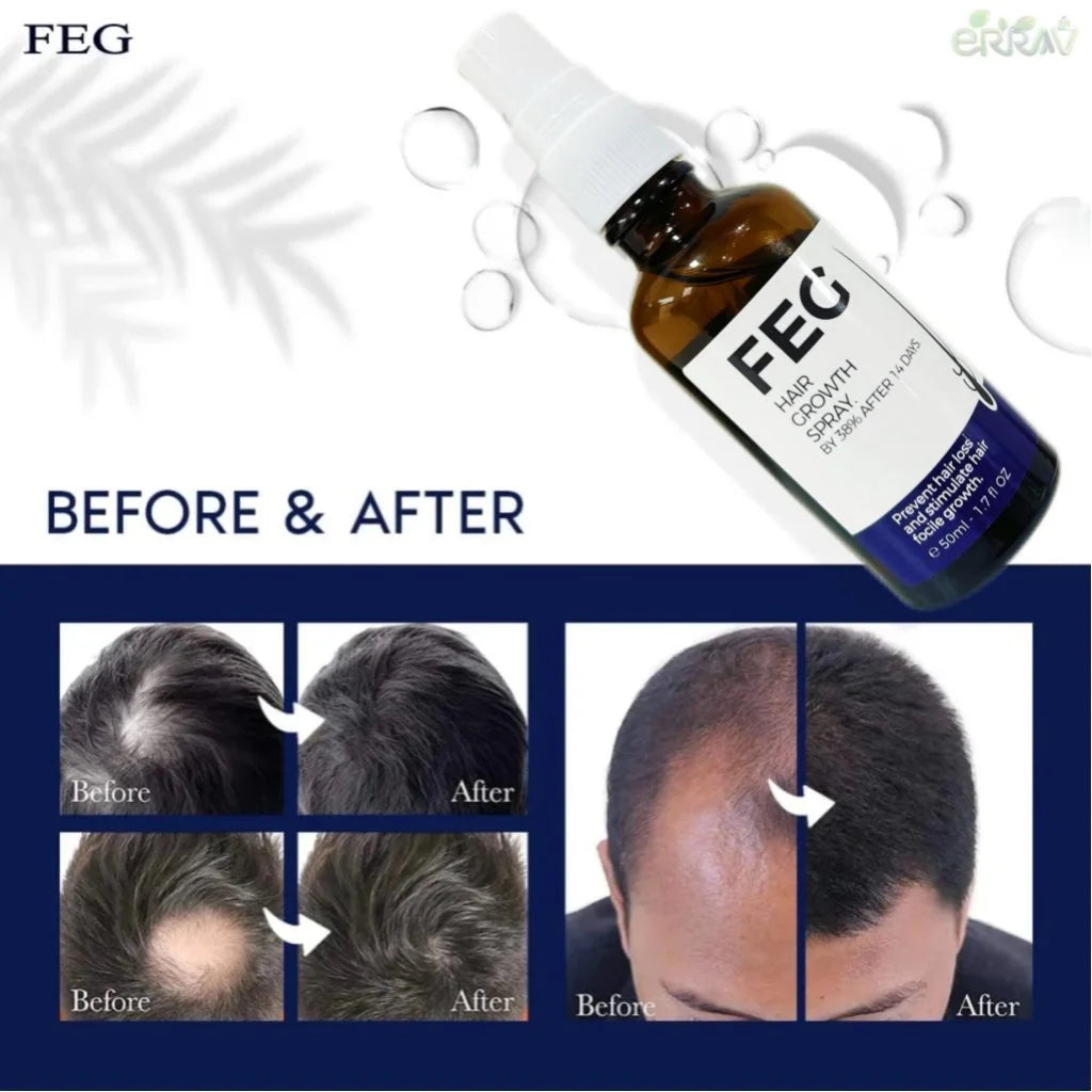 FEG Plus  Hair Growth spry